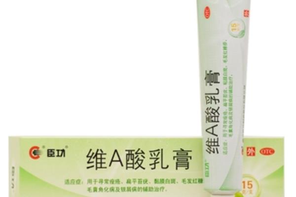 维a酸乳膏可以去黑头吗